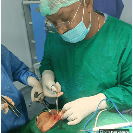 Advanced ENT Surgery Procedure